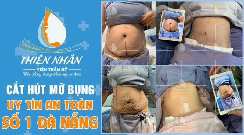 Skincare Vien Tham My Thien Nhan 547177