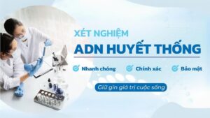 Xetnghiemadnhcm-chonthuonghieu-2