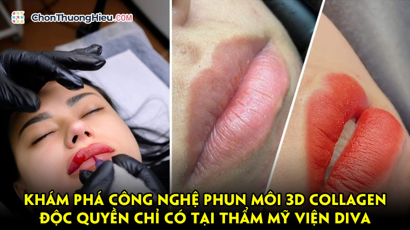 Kham-pha-cong-nghe-phun-moi-3d-collagen-doc-quyen-chi-co-tai-tham-my-vien-diva-chonthuonghieu