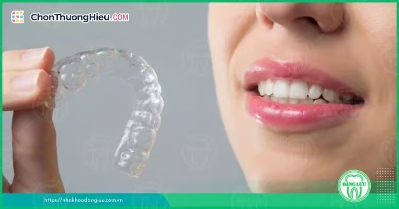 Nhung-dich-vu-nha-khoa-uy-tin-tai-nha-khoa-dang-luu-chonthuonghieu