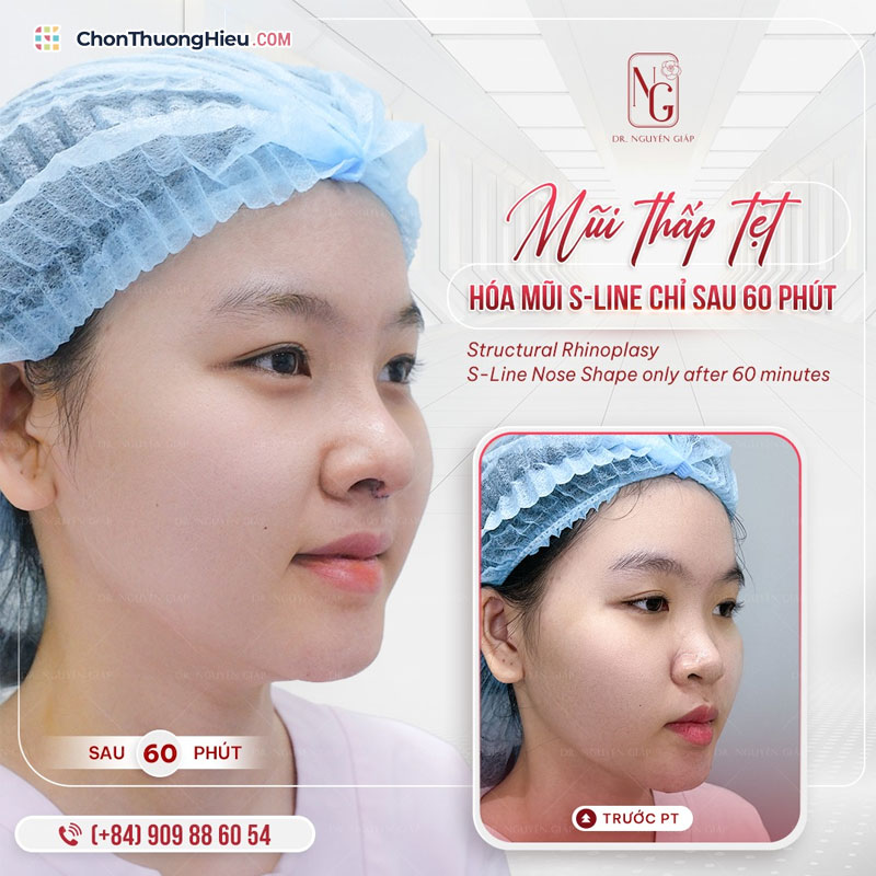 Khach-hang-noi-gi-sau-khi-lam-dep-tai-tham-my-vien-dr-nguyen-giap-chonthuonghieu