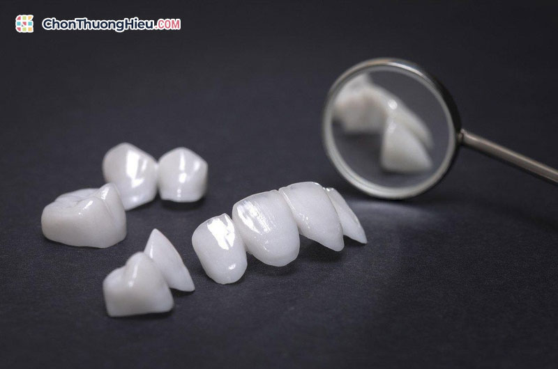 Nha khoa Đông Nam giải đáp: Bọc răng sứ có đau không và quy trình nhẹ nhàng Cham-soc-hau-dieu-tri-chonthuonghieu