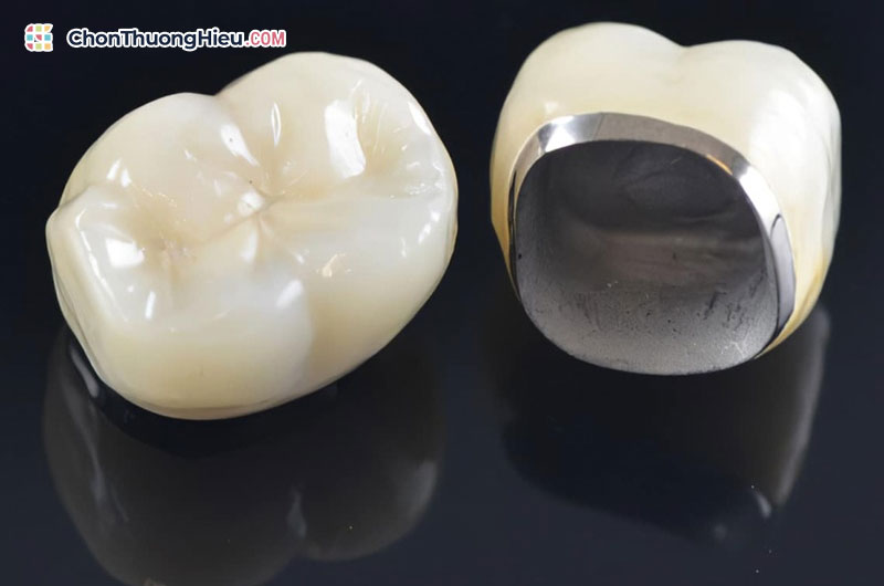 Nha khoa Đông Nam giải đáp: Bọc răng sứ có đau không và quy trình nhẹ nhàng Quy-trinh-boc-rang-su-tai-nha-khoa-dong-nam-chonthuonghieu