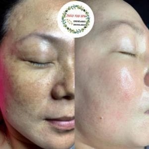 Thảo Yuu Beauty & Spa Quận 7 Hồ Chí Minh