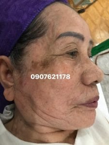 Thẩm mỹ viện Diễm Phương Hải Phòng