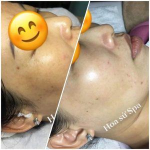 Hoa Sứ Spa Q.12 TP Hồ Chí Minh