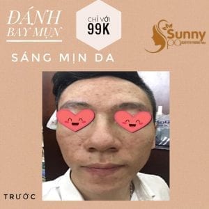 Sunny Spa Q.12 TP Hồ Chí Minh