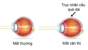 Khoa mắt bệnh viện đa khoa thành phố Cần Thơ