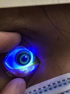 Phòng khám chuyên khoa mắt và mắt kính Thanh Liệt Cần Thơ