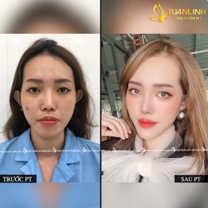 Viện thẩm mỹ Tuấn Linh TPHCM